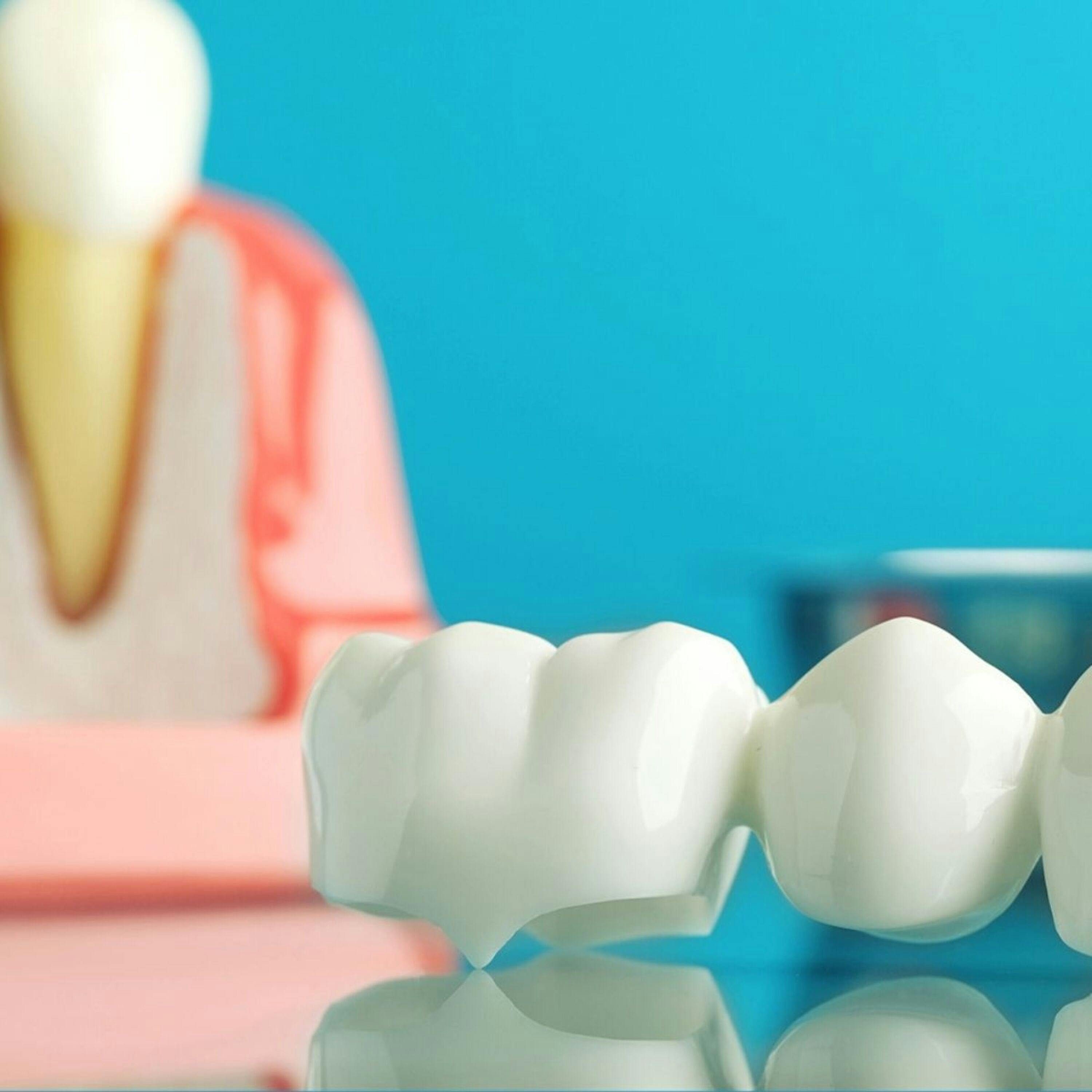 Zirconia and full-ceramic dental crowns at the Rahhal clinic, Amman