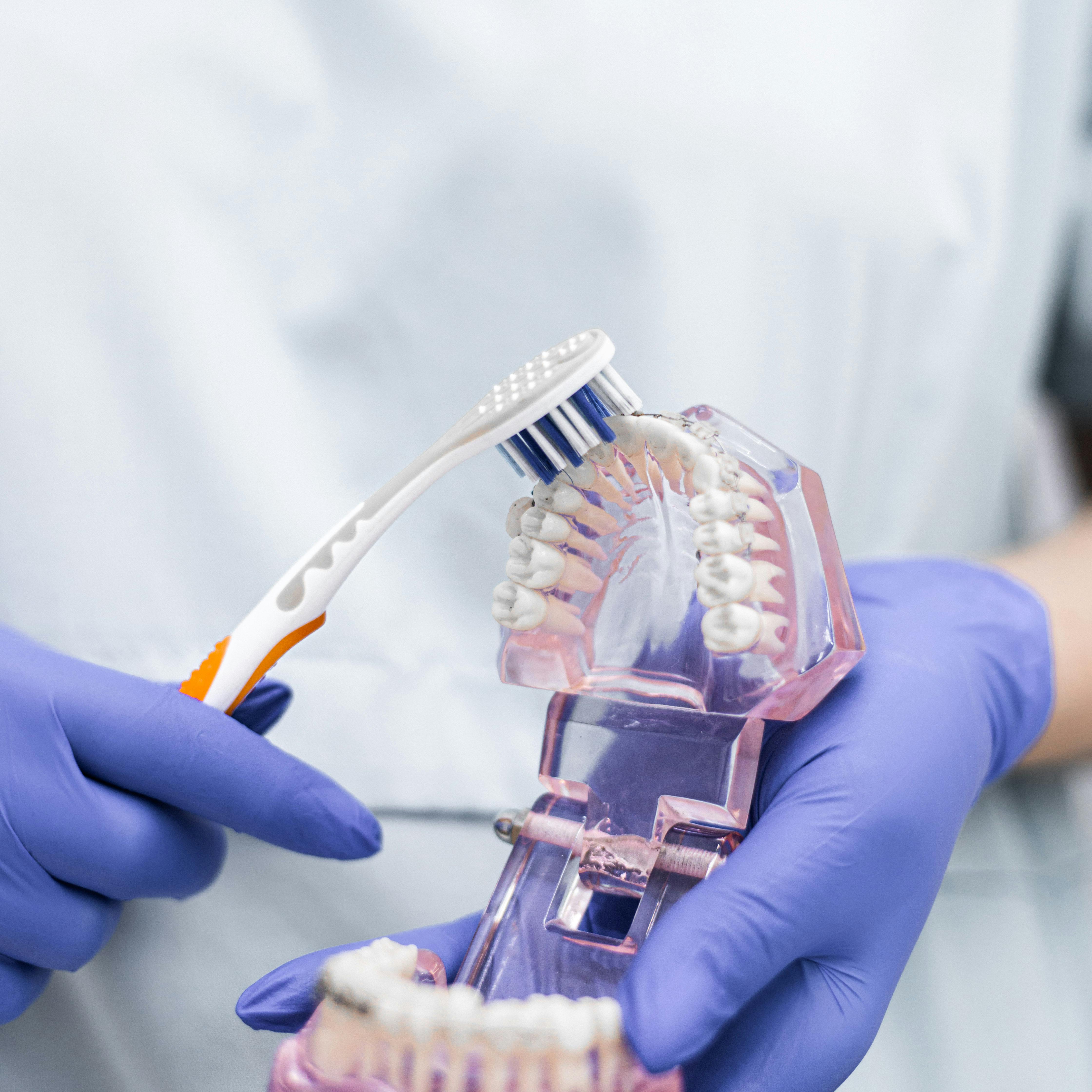 Clear aligners and orthodontic treatment — Dr. Rahhal Dental Clinic, Amman