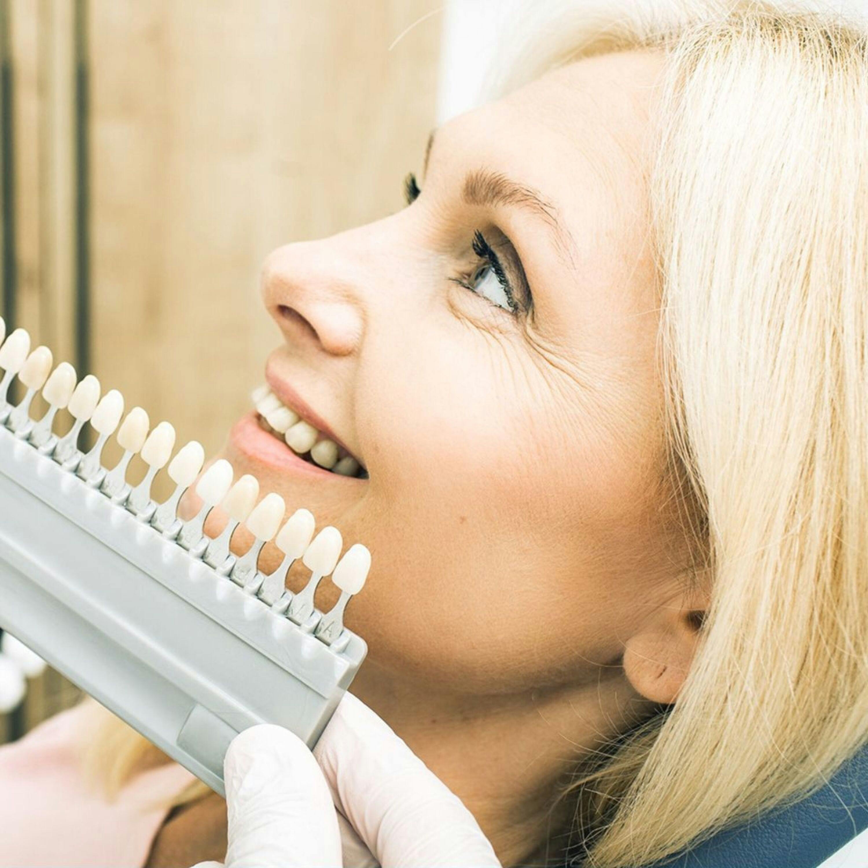 Professional teeth whitening (enamel-safe protocol), Rahhal Dental Amman